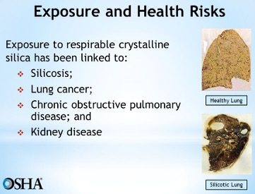 Silica Exposure and Health Risks attorney